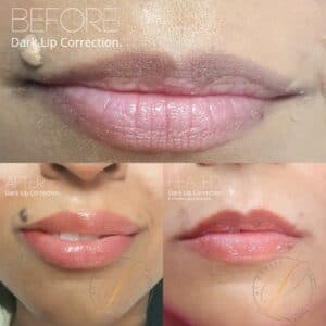 Geelong Cosmetic Tattoo