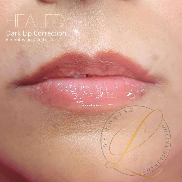 Dark Lip Correction Cosmetic Tattoo by Louise Australia