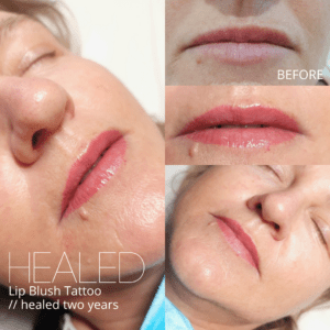 BEFORE AND AFTER lip blush tattoo