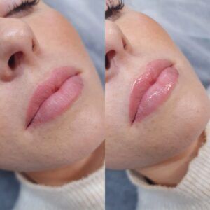 A close-up, split image shows a person's natural pink lips on the left and glossy, enhanced pink lips on the right.