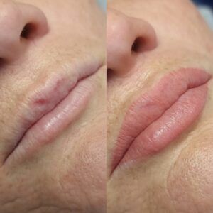 Close-up before and after image of a person's lips, showing pale lips with a red spot on the left and freshly tattooed pink lips with a defined outline on the right.