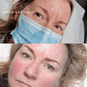 A woman's face before and after permanent makeup, showing healed permanent eyeliner and freshly defined, fuller eyebrows.