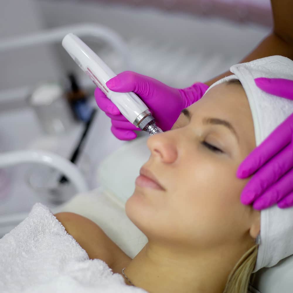 A woman receiving a professional microneedling facial treatment from an aesthetician wearing pink gloves.