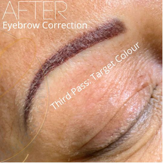 Close-up of an eyebrow after a third pass of correction, showing the target color pigment applied to the skin.