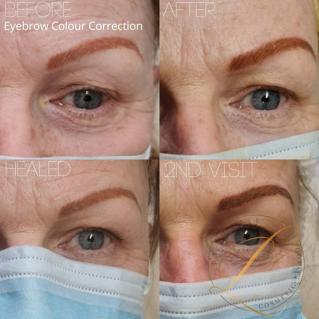 Four close-up images showing an eyebrow's color correction process: before, immediately after, healed, and after a second visit.