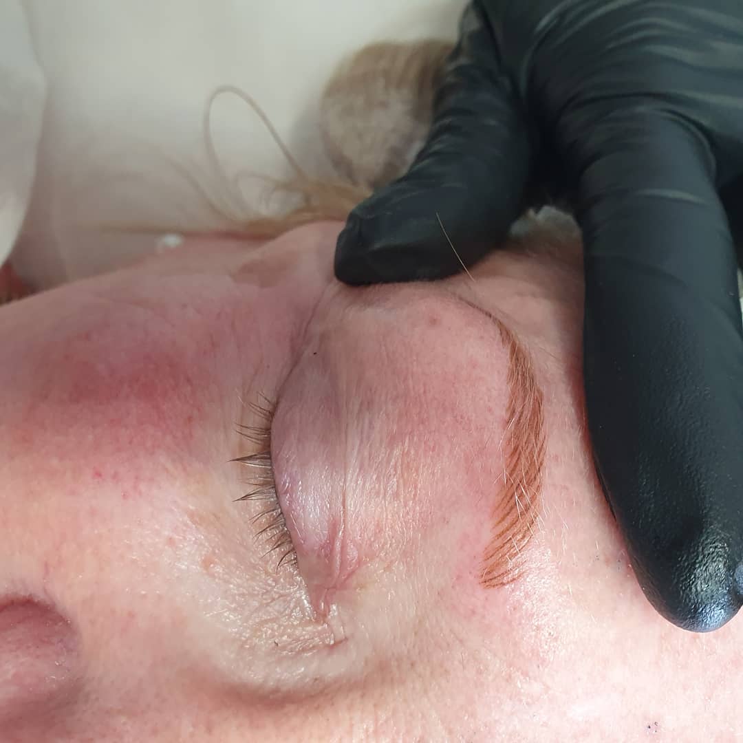 Close-up of a person's eye with a partially microbladed eyebrow, showing hair-like strokes and a gloved hand stretching the skin.
