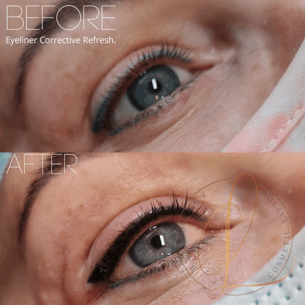 A before and after close-up of an eye showing a corrective refresh of permanent eyeliner, transitioning from faded blue to a crisp, black, well-defined line.