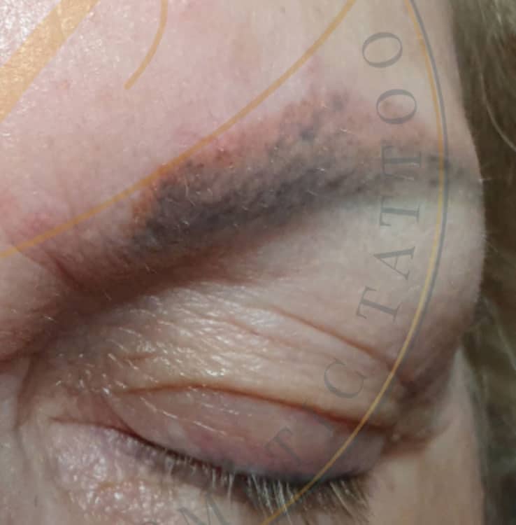 Close-up of a faded, dark grey eyebrow tattoo on a person's face with their eye closed.