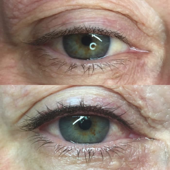 A close-up before-and-after comparison of an eye, showing the upper eyelid without eyeliner in the top image and with permanent black eyeliner applied in the bottom image.