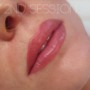 Close-up of glossy, pink lips after a 2nd cosmetic session, with '2ND SESSION' text visible above the mouth.