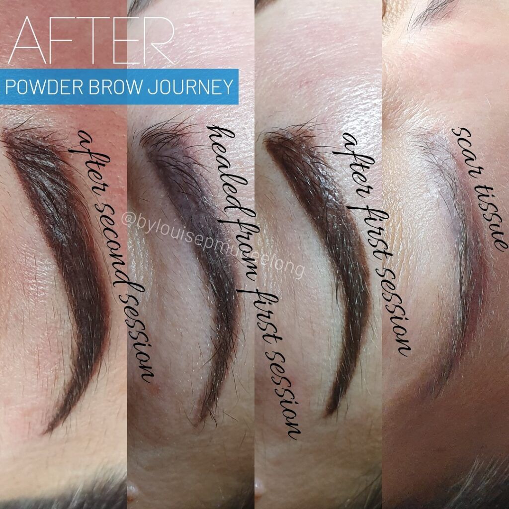A four-panel image showing the powder brow journey, from initial scar tissue to the final result after two sessions.