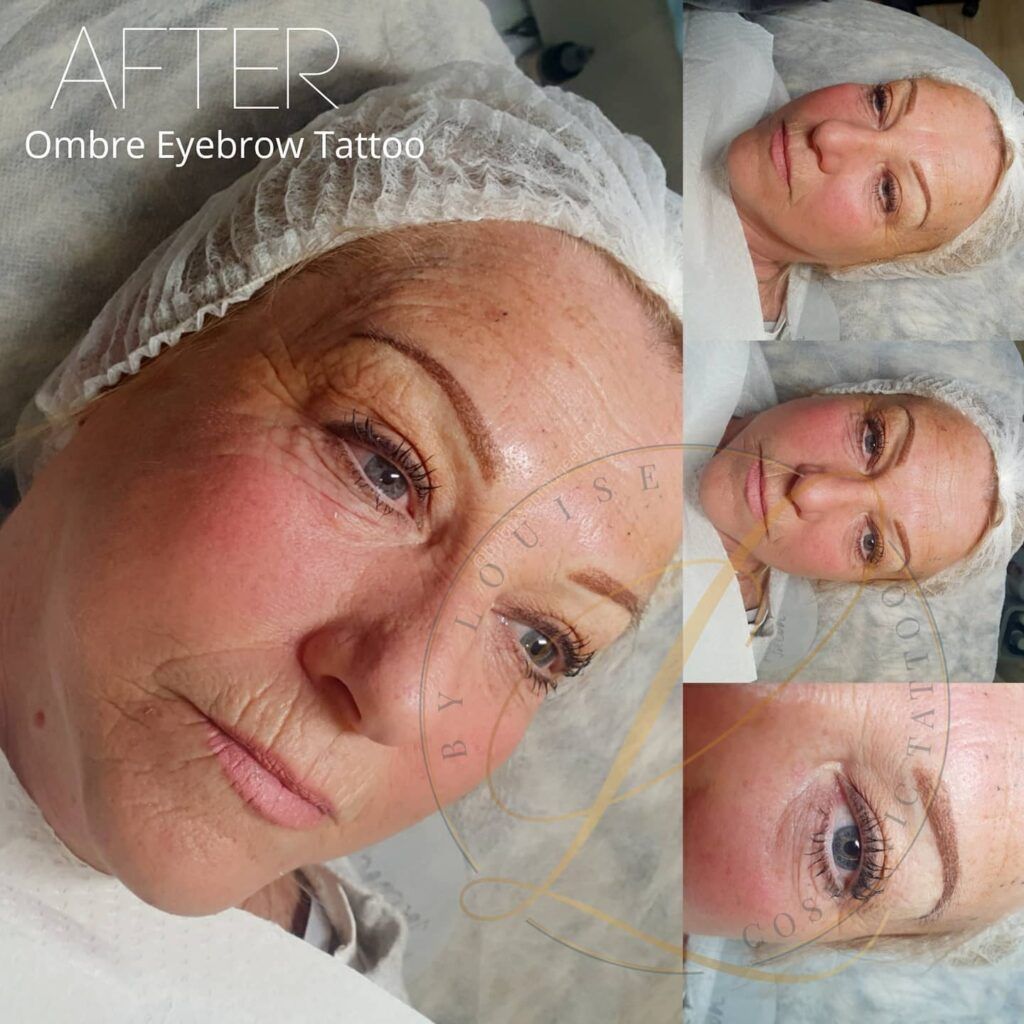 A woman after an ombre eyebrow tattoo procedure, showing her newly defined eyebrows and face in multiple views.